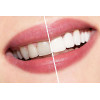 Зубная паста против налета AP24 фтористая Anti-plaque Fluoride Toothpaste Nu Skin 170 г